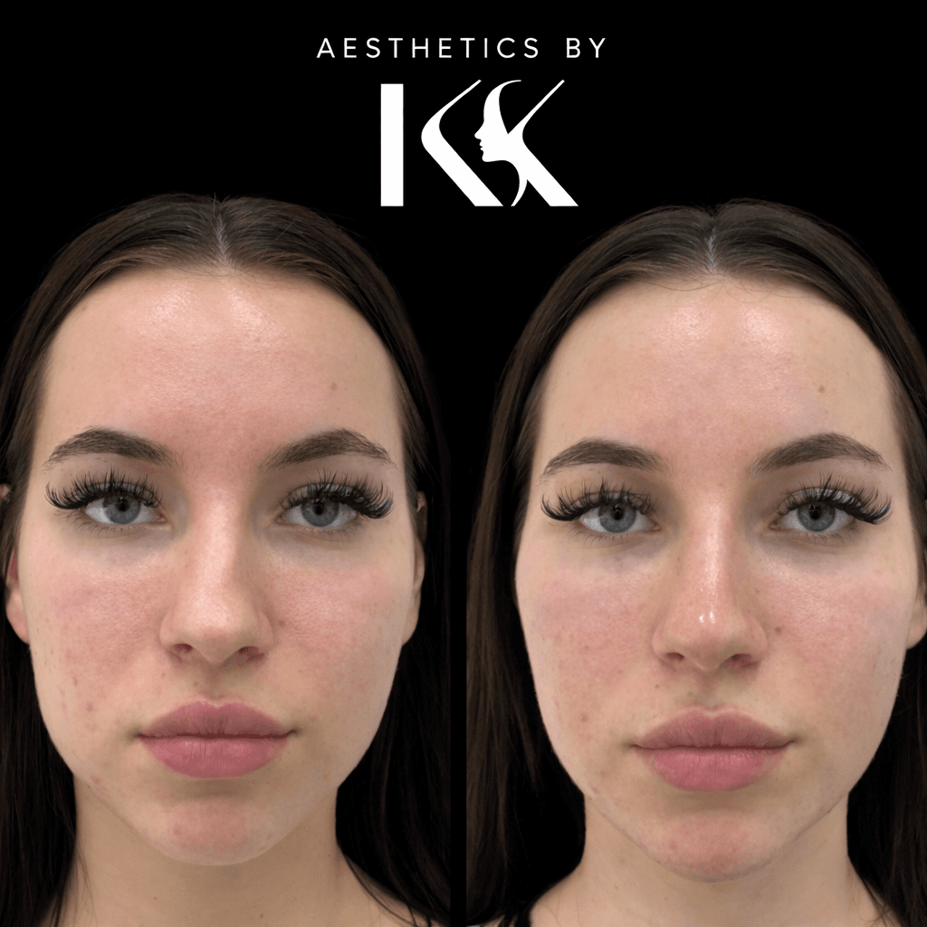 Aesthetic transformation results at Aesthetics by KK