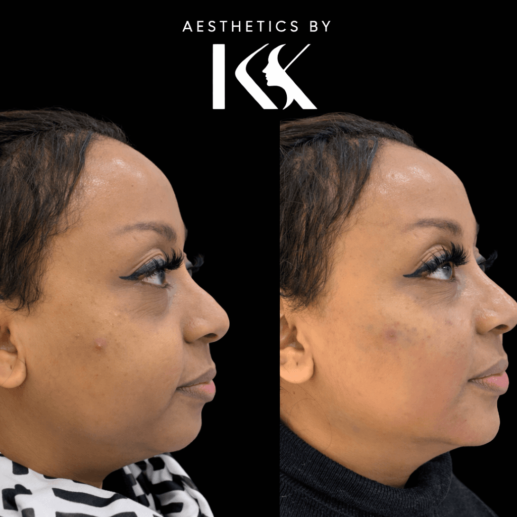 Aesthetic transformation showcase at Aesthetics by KK