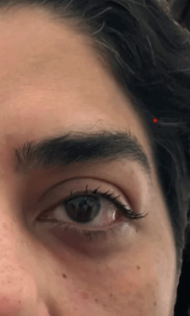 Close-up of an eye during consultation