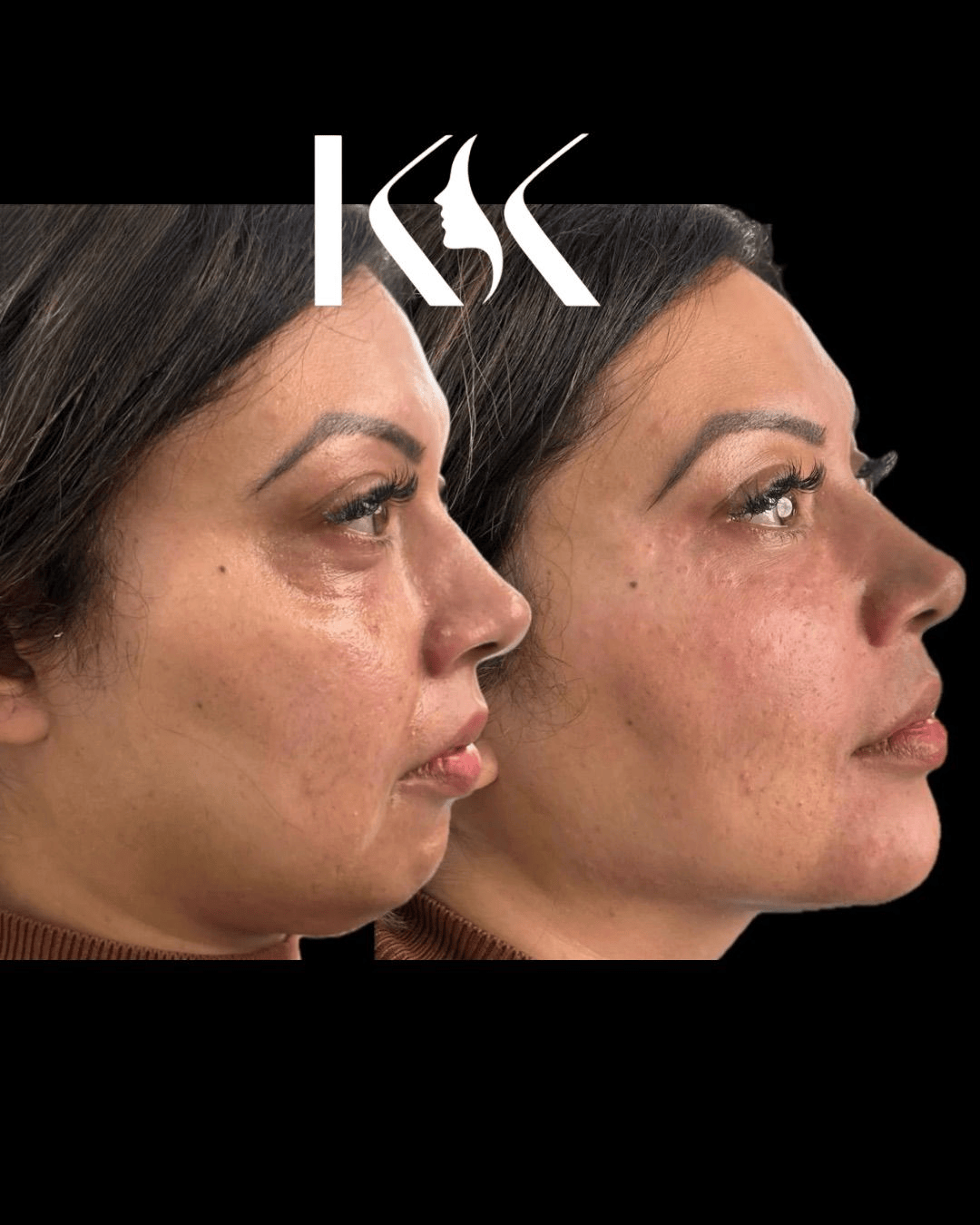 Aesthetics by KK — carousel 2