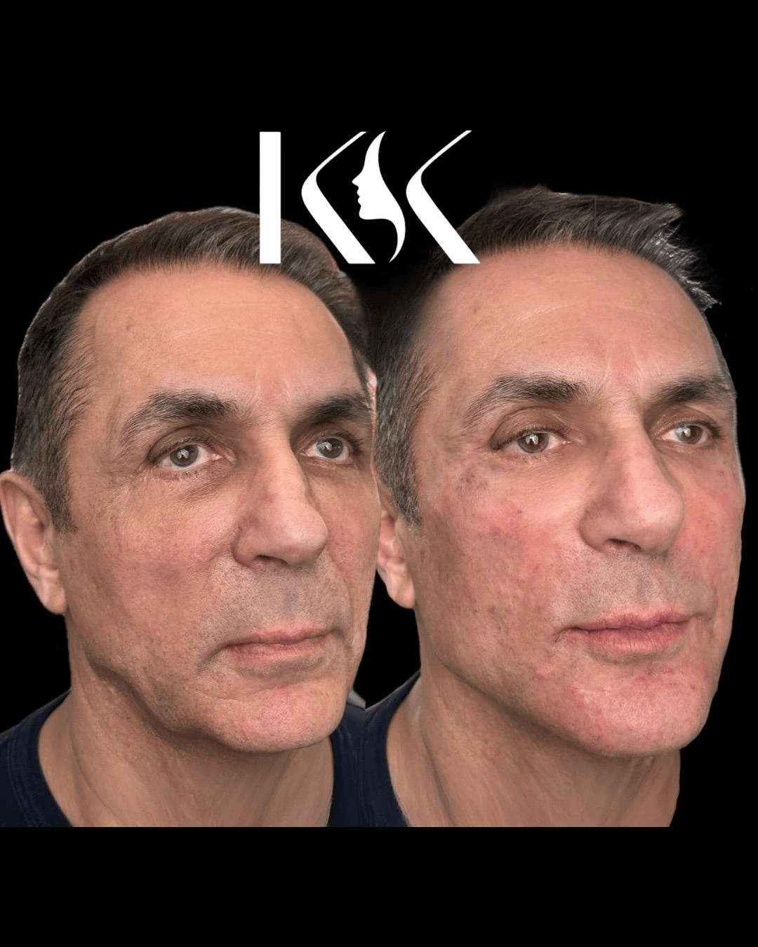 Aesthetics by KK — carousel 3