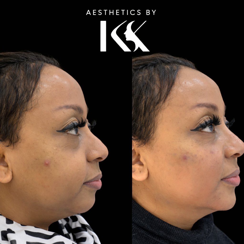 Aesthetics by KK portfolio 3