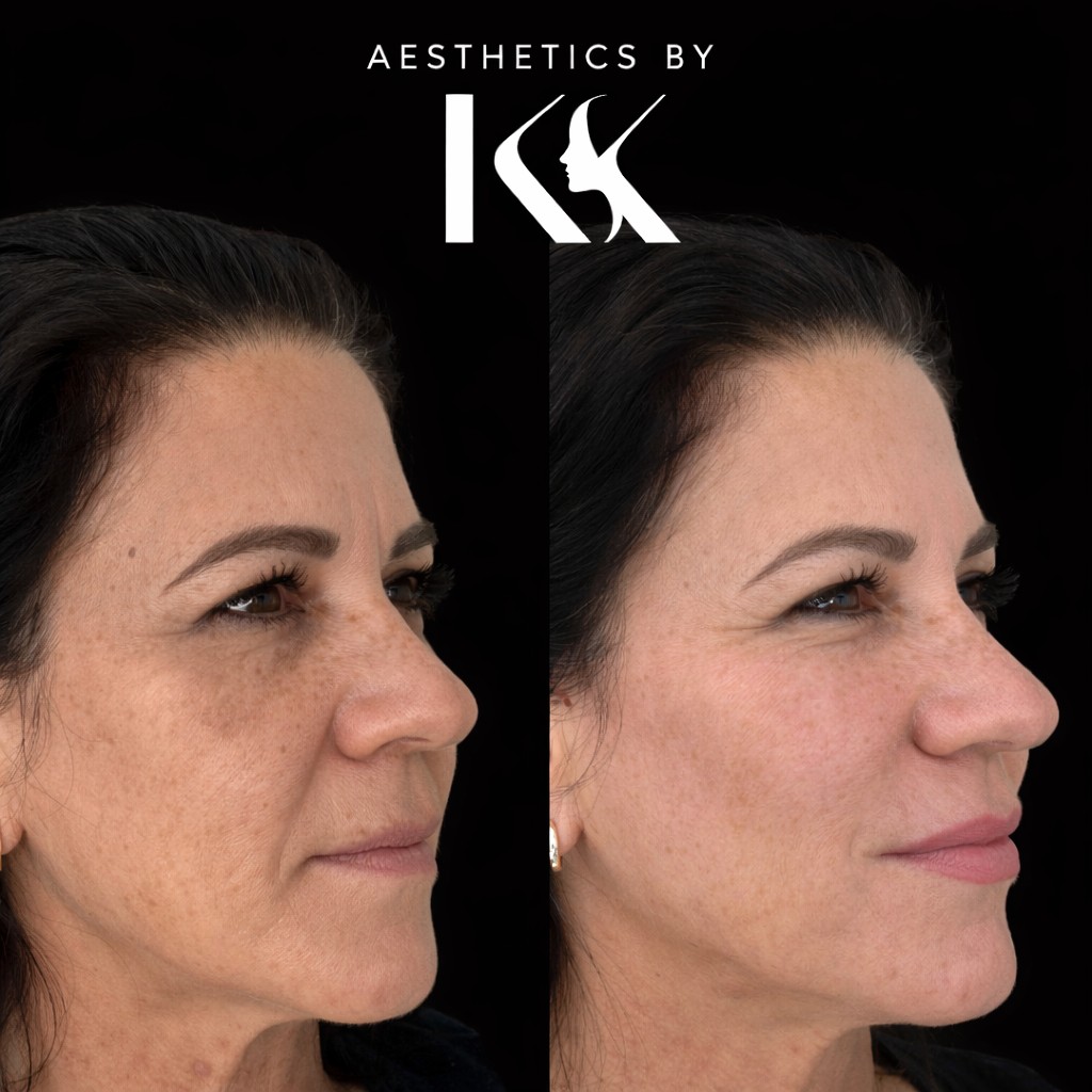 Aesthetics by KK portfolio 4