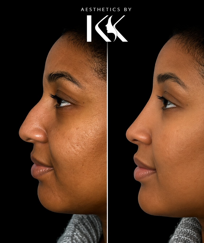 Aesthetics by KK portfolio 5