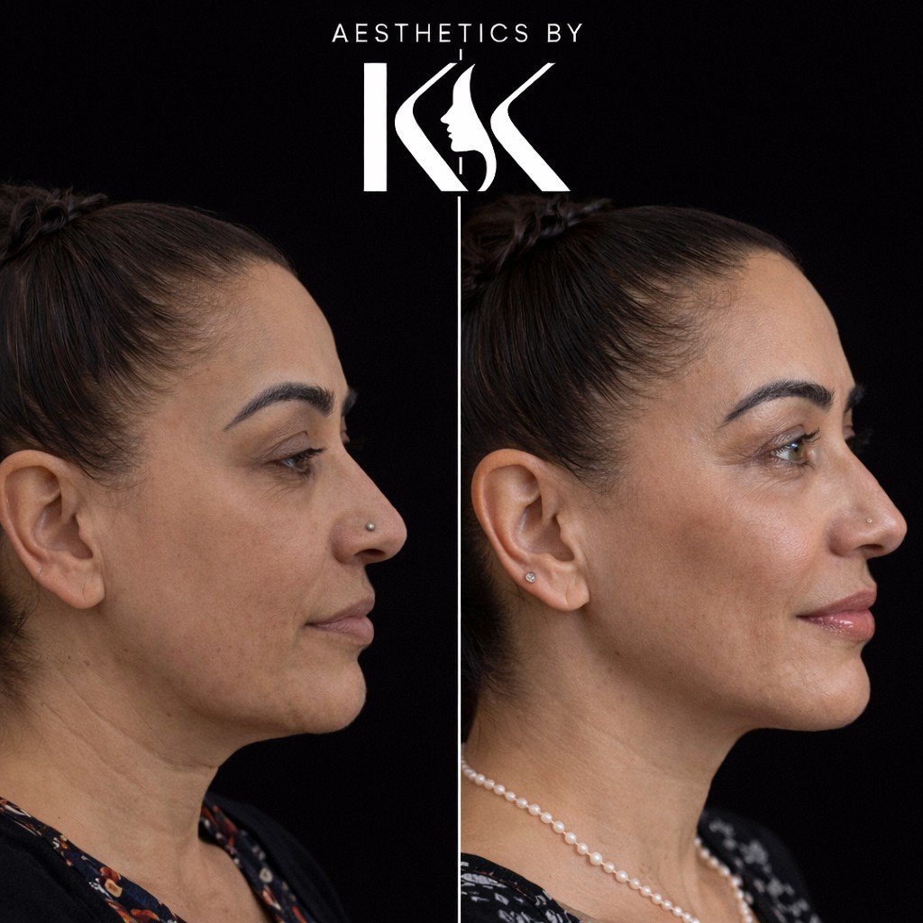 Aesthetics by KK portfolio 10