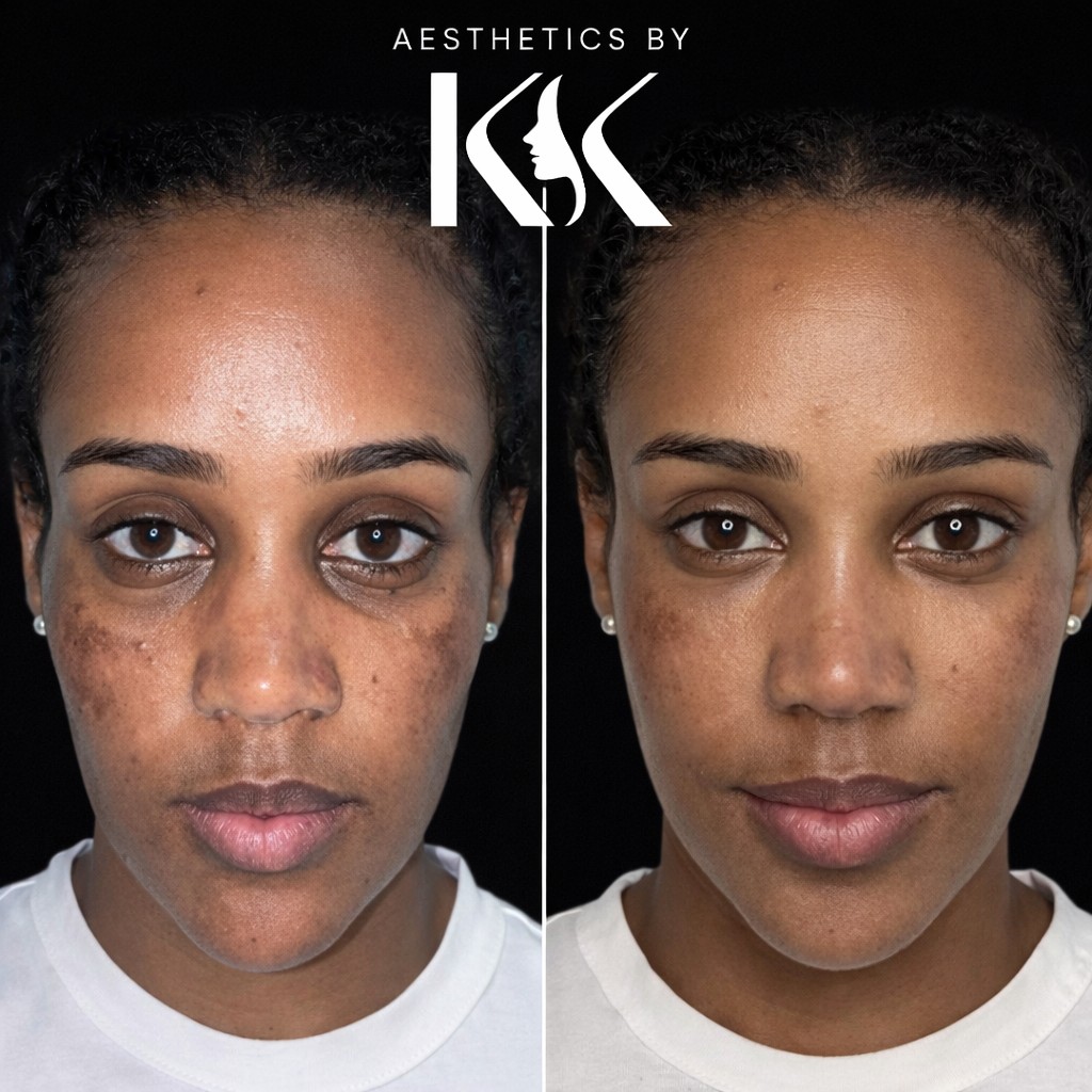 Aesthetics by KK portfolio 14