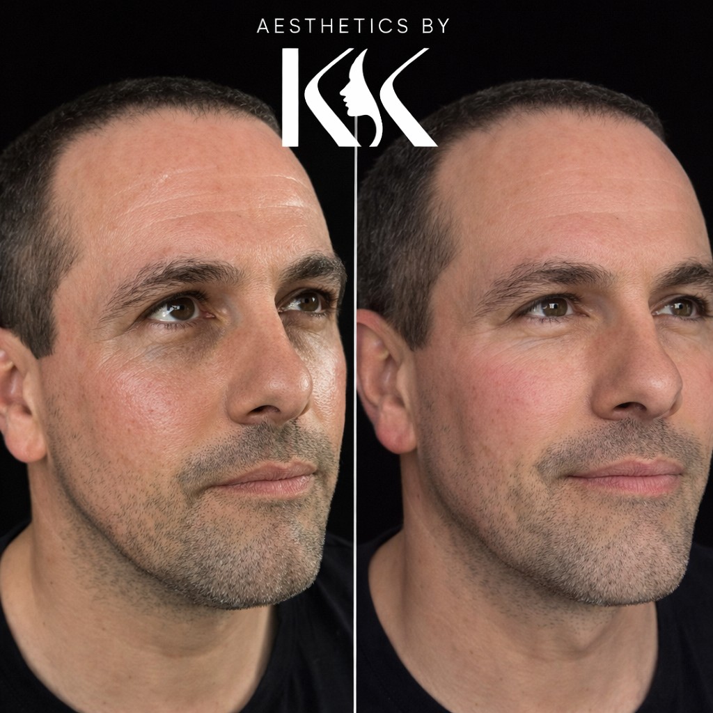 Aesthetics by KK portfolio 16