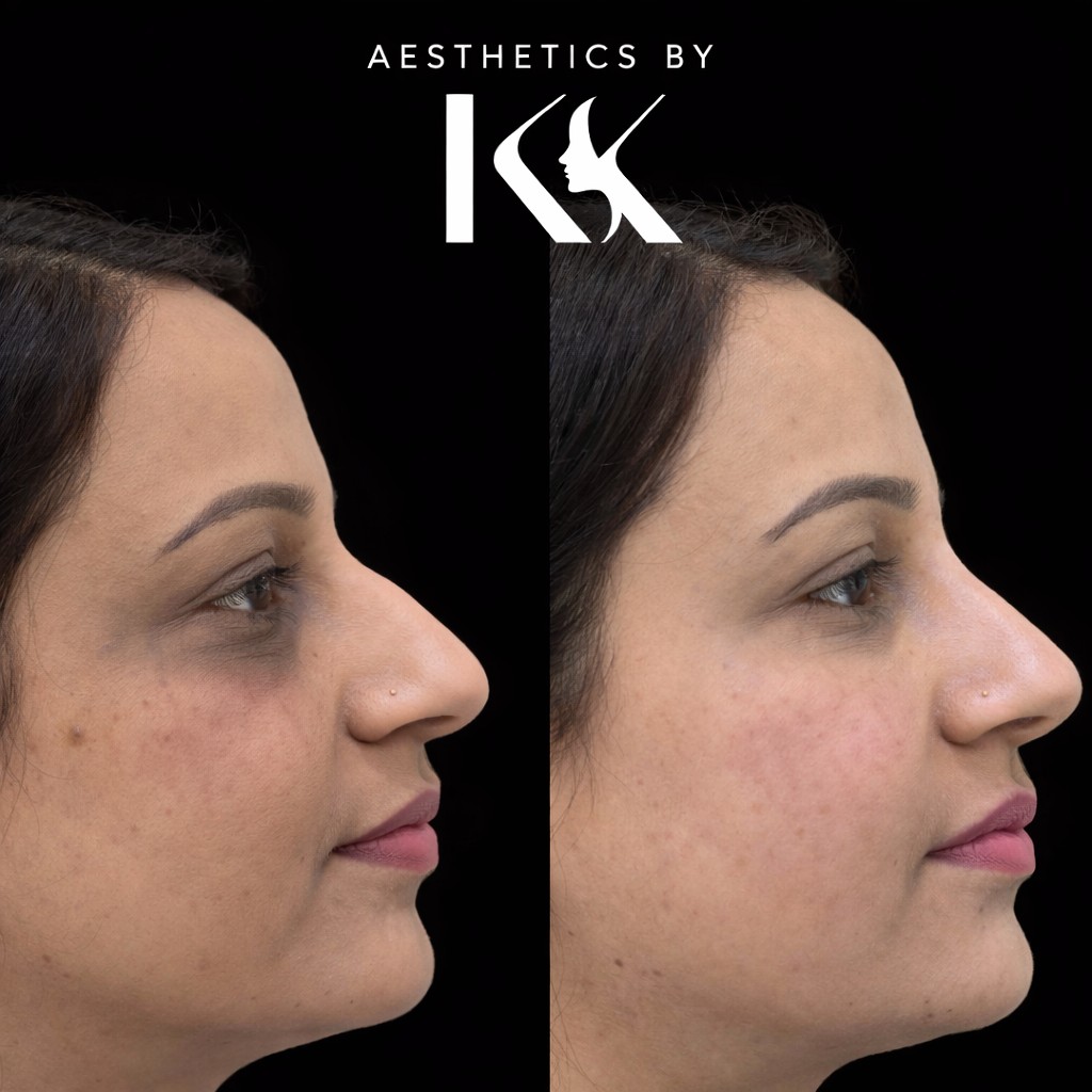 Aesthetics by KK portfolio 23